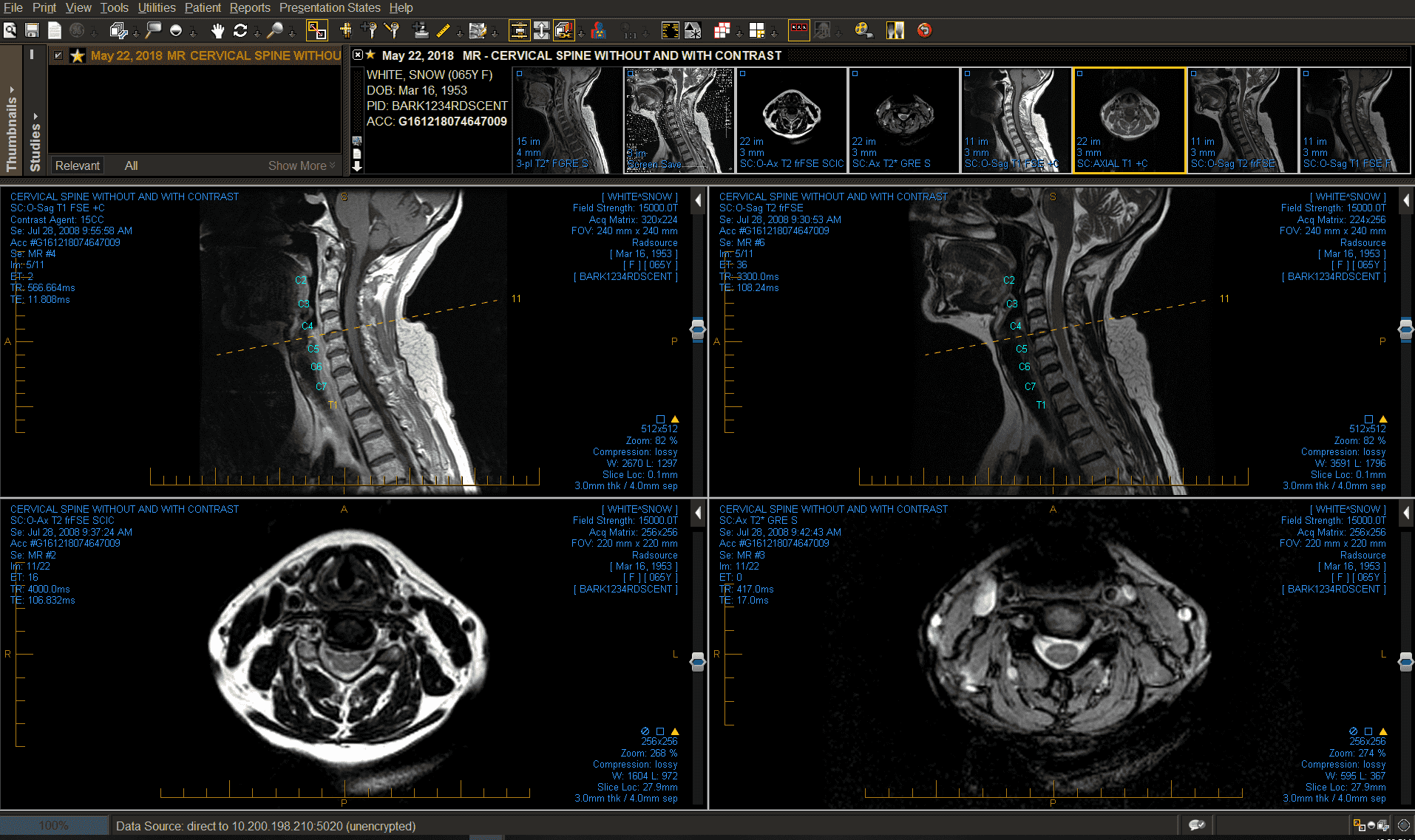 Spine_labeling